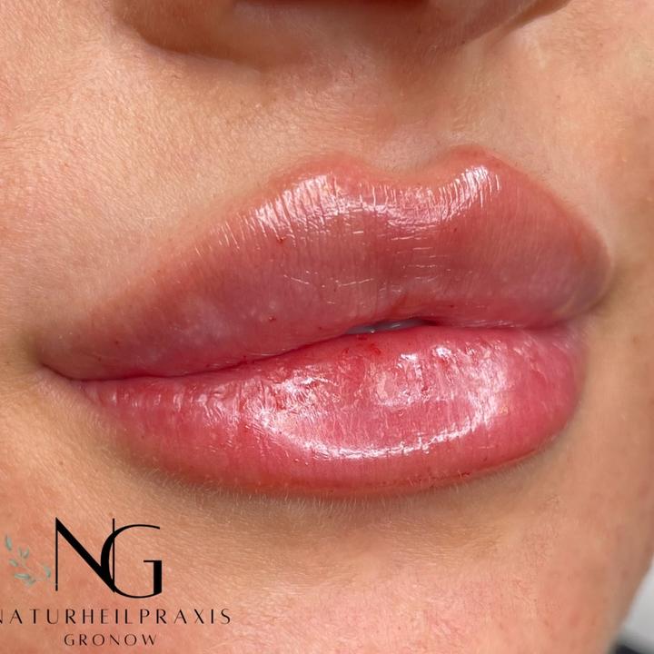 nasenbehandlung TikTok Hashtag